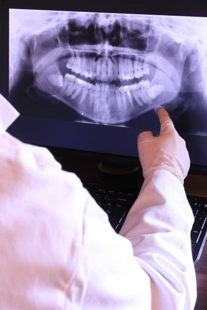 Best Emergency Treatment for Dental Infections or Abscesses in Avra Valley, AZ